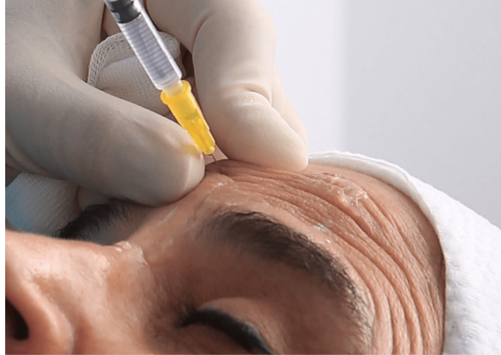 8. neuromoduladores​ dra olga correa medicina estética en cartagena